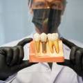 How Much Does Insurance Pay for Dental Implants?