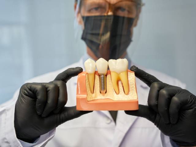 How Much Does Insurance Pay for Dental Implants?